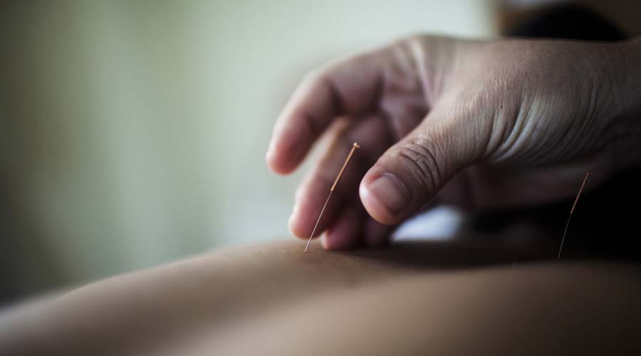 Acupuncture : équilibre et bien-être